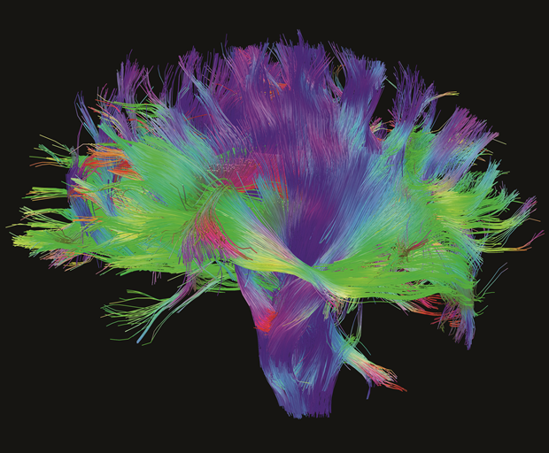 Mapping the Brain, 2014, Human Connectome Project  Digital, dimensions variable. Courtesy of the Laboratory of Neuro Imaging and Martinos Center for Biomedical Imaging, Consortium of the Human Connectome Project. From Map
