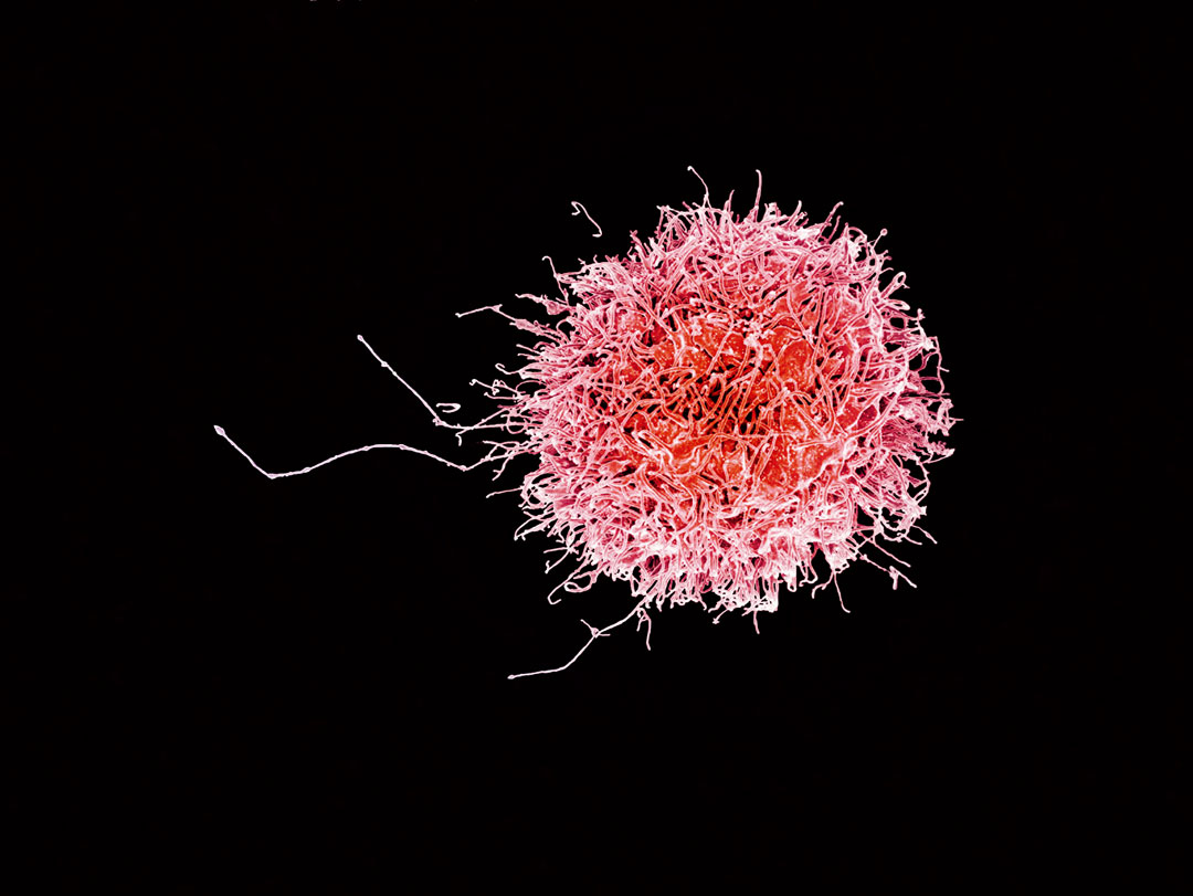 Human natural killer cell, 2016, National Institute of Allergy and Infectious Diseases; coloured scanning electron micrograph