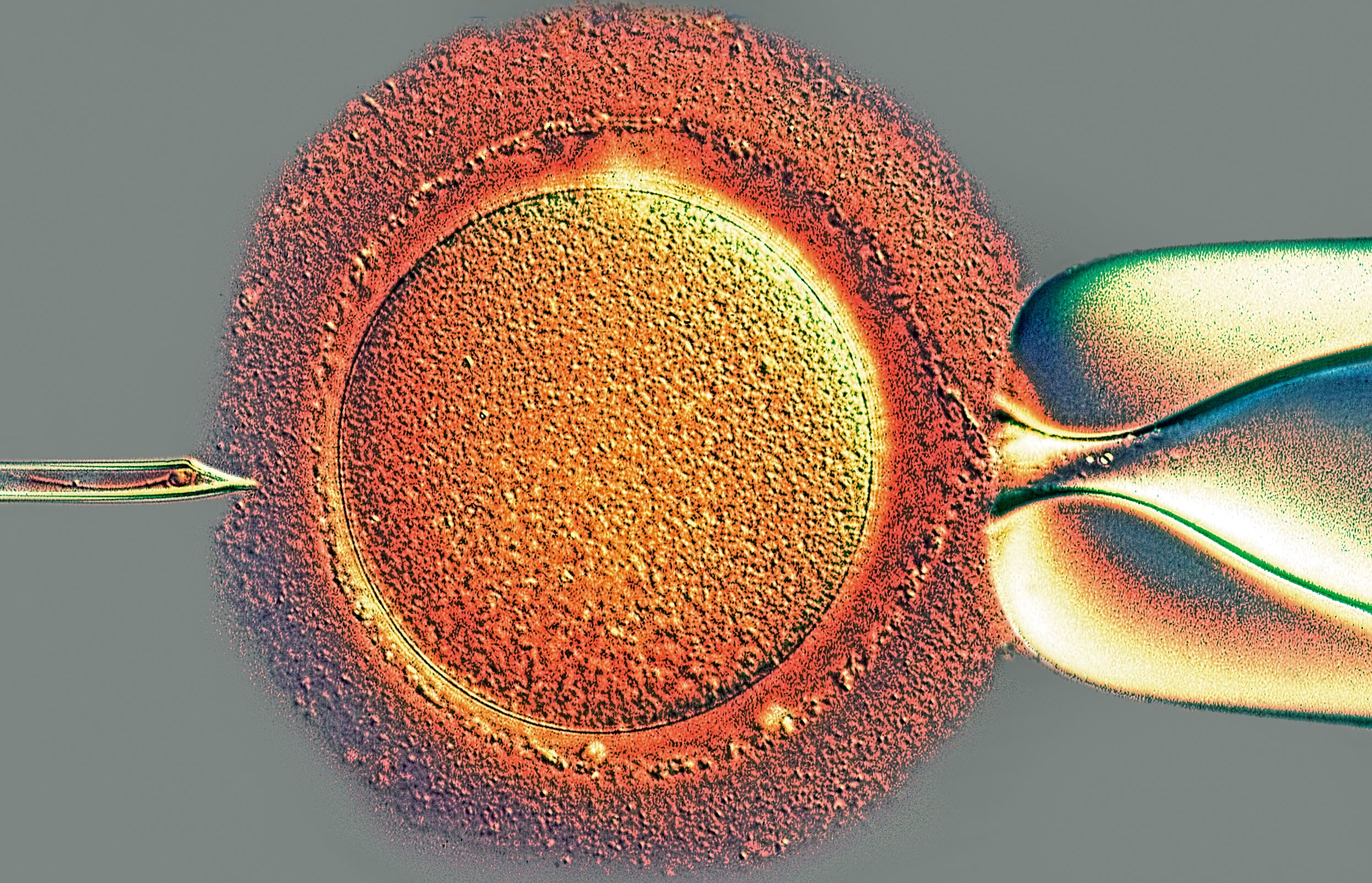 A single sperm being inserted into a prepared egg cell, c.2004, Spike Walker